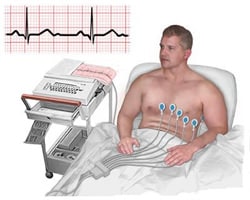 Elektrokardiyografi EKG Nedir