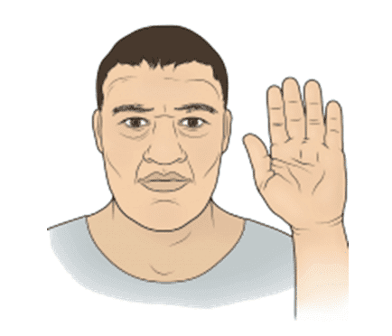 Akromegali (Dev Hastalığı)