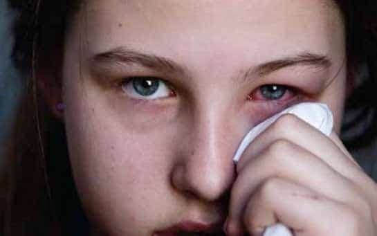 Behçet Hastalığı Belirtileri