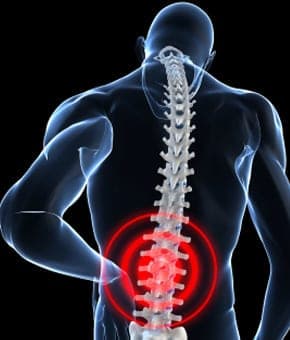 Bel Ağrısı ve Bel Fıtığı Belirtileri