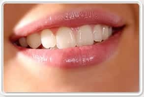 Diş Rengi Beyazlatma