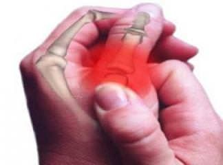 Enteropatik Artrit Nedir?