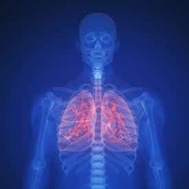 Kronik Obstriktif Akciğer Hastalığı