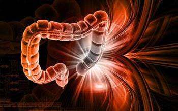 İnvajinasyon (Bağırsak Düğümlenmesi)