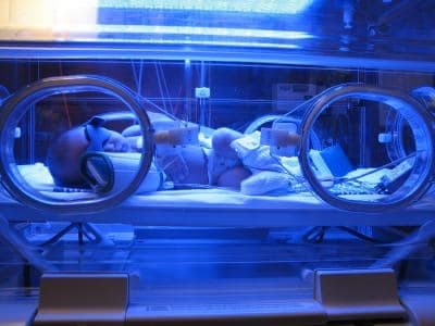 Fizyolojik Sarılık