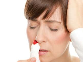 Burun Kanaması Nasıl Geçer?