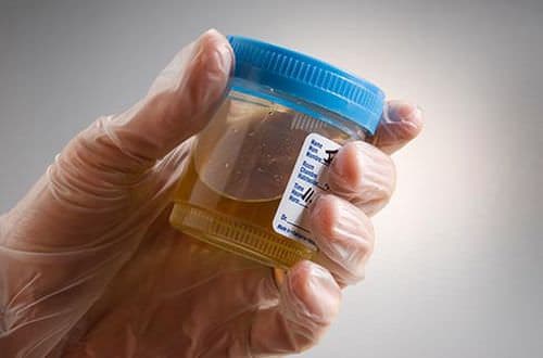 Vanil Mandelik Asit (VMA) Testi Diyeti