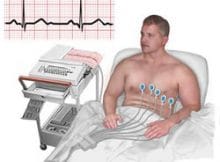 Elektrokardiyografi (EKG) Nedir