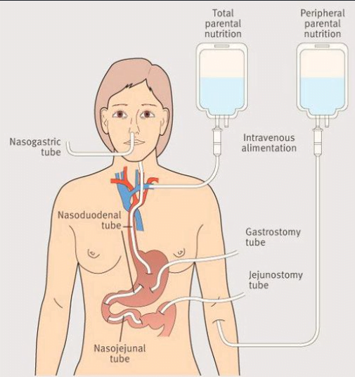 enteral