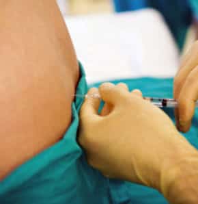 Epidural Anestezi