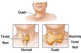 Guatr