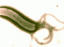 Helicobacter Pylori