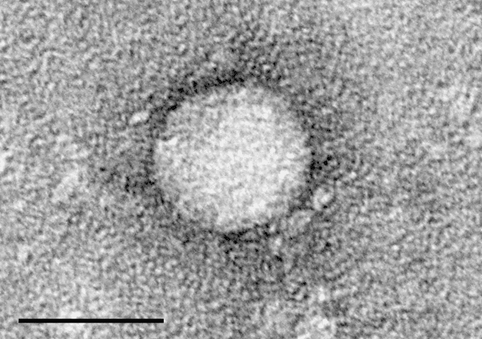 Hepatit Paneli (Hepatit A,Hepatit B,Hepatit C,Hepatit D)
