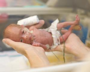 İNTRAUTERİN BÜYÜME GERİLİĞİ