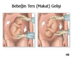 Makat Doğum