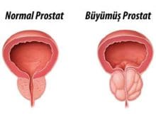 Prostat