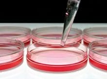 Ürogenital Mycoplasma Kültürü ve Antibiyotik Duyarlılık Testi