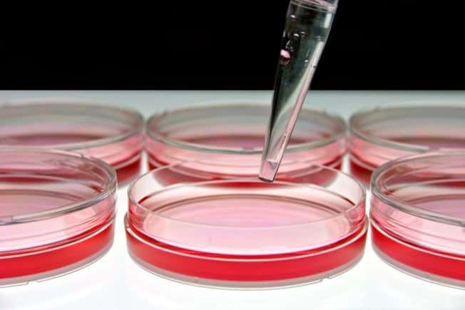 Ürogenital Mycoplasma Kültürü ve Antibiyotik Duyarlılık Testi